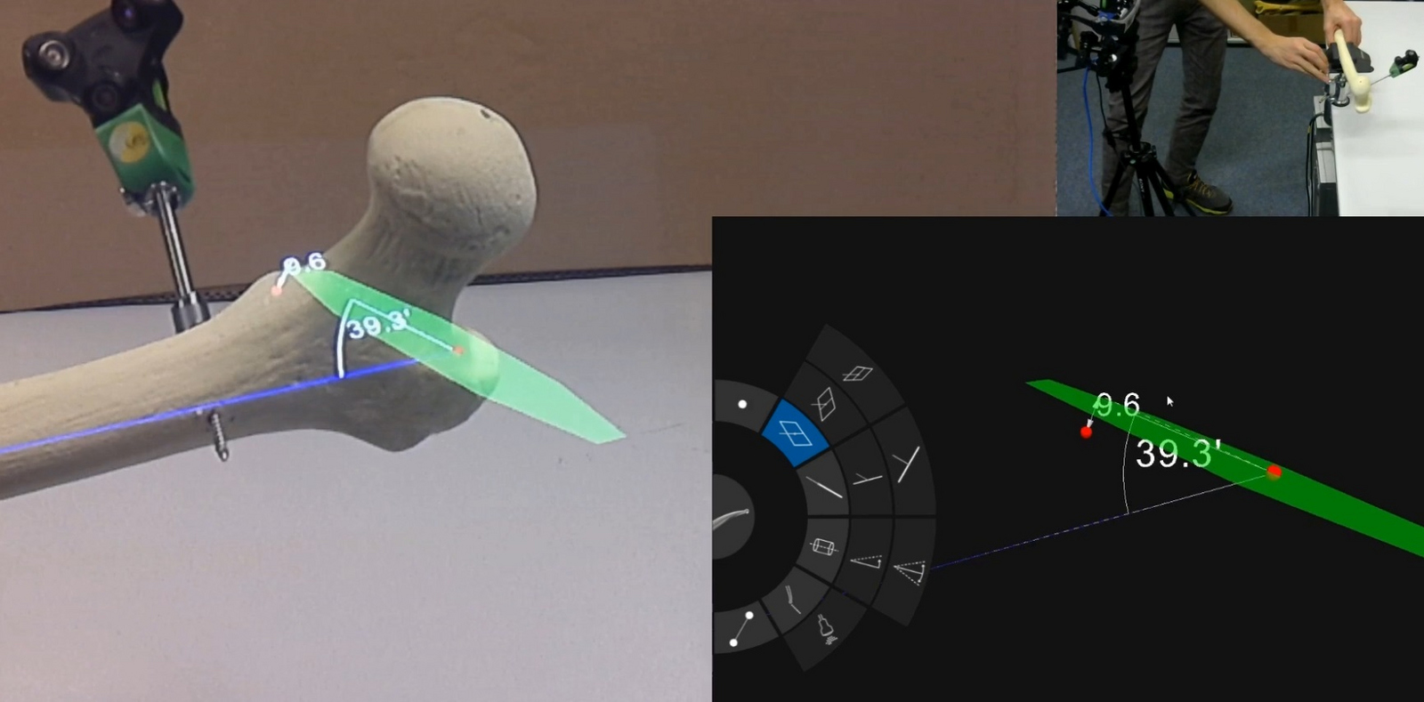 Das dreigeteilte Bild zeigt links den Blick durch die Augmented-Reality-Brille auf den Femur mit den Planungsdaten, rechts oben den Versuchsaufbau mit Brille und Femur und rechts unten die Darstellung der Planungsdaten am Monitor.