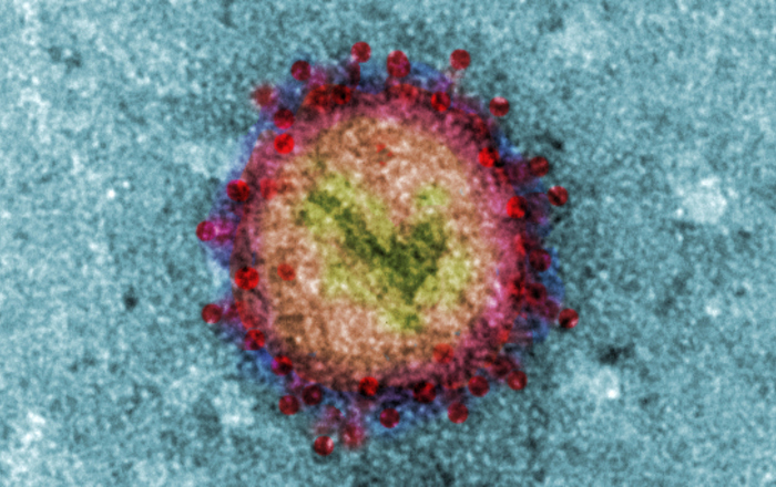 Bild von Virus